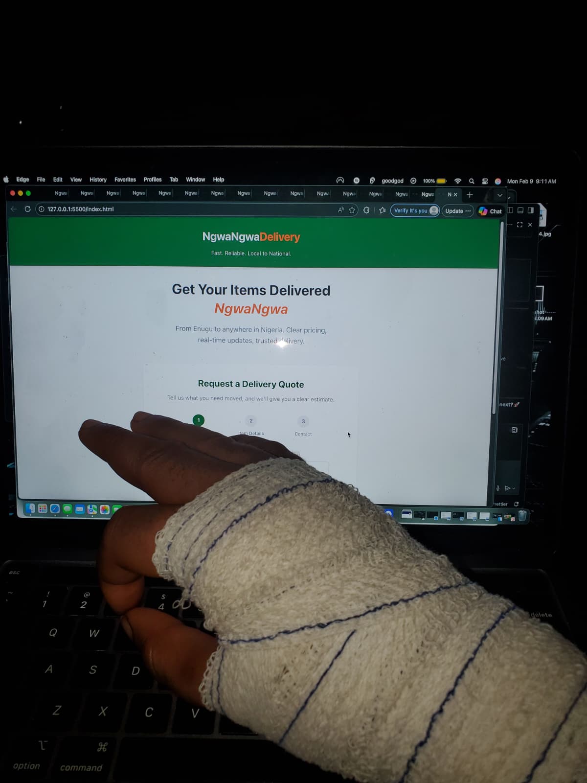 Building with a bandaged hand — stay stubborn